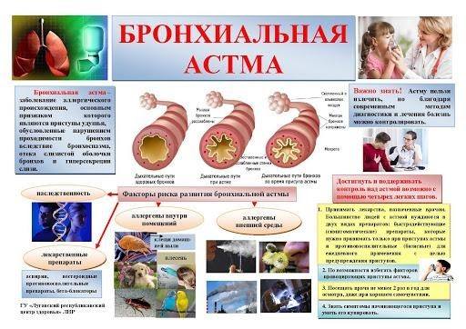 Степени и формы бронхиальной астмы