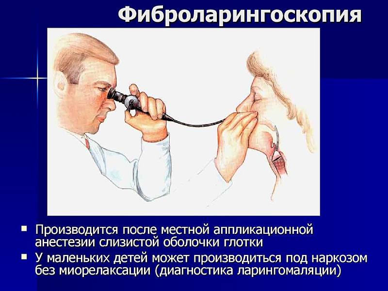 Фиброларингоскопия - метод диагностики трахеита