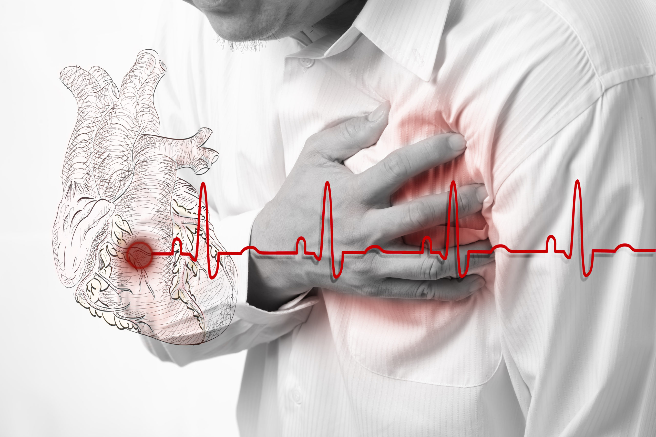 Коронарная или внезапная сердечная смерть – причины, симптомы, профилактика