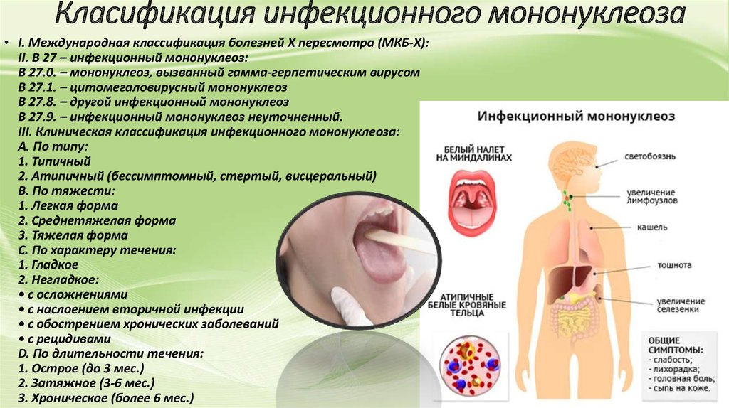 Причины развития инфекционного мононуклеоза