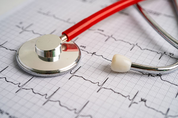 Мерцательная аритмия сердца (Фибрилляция предсердий) – что это такое, симптомы и лечение